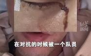 雷速体育官网首页-球星重伤需紧急动手术救治的简单介绍