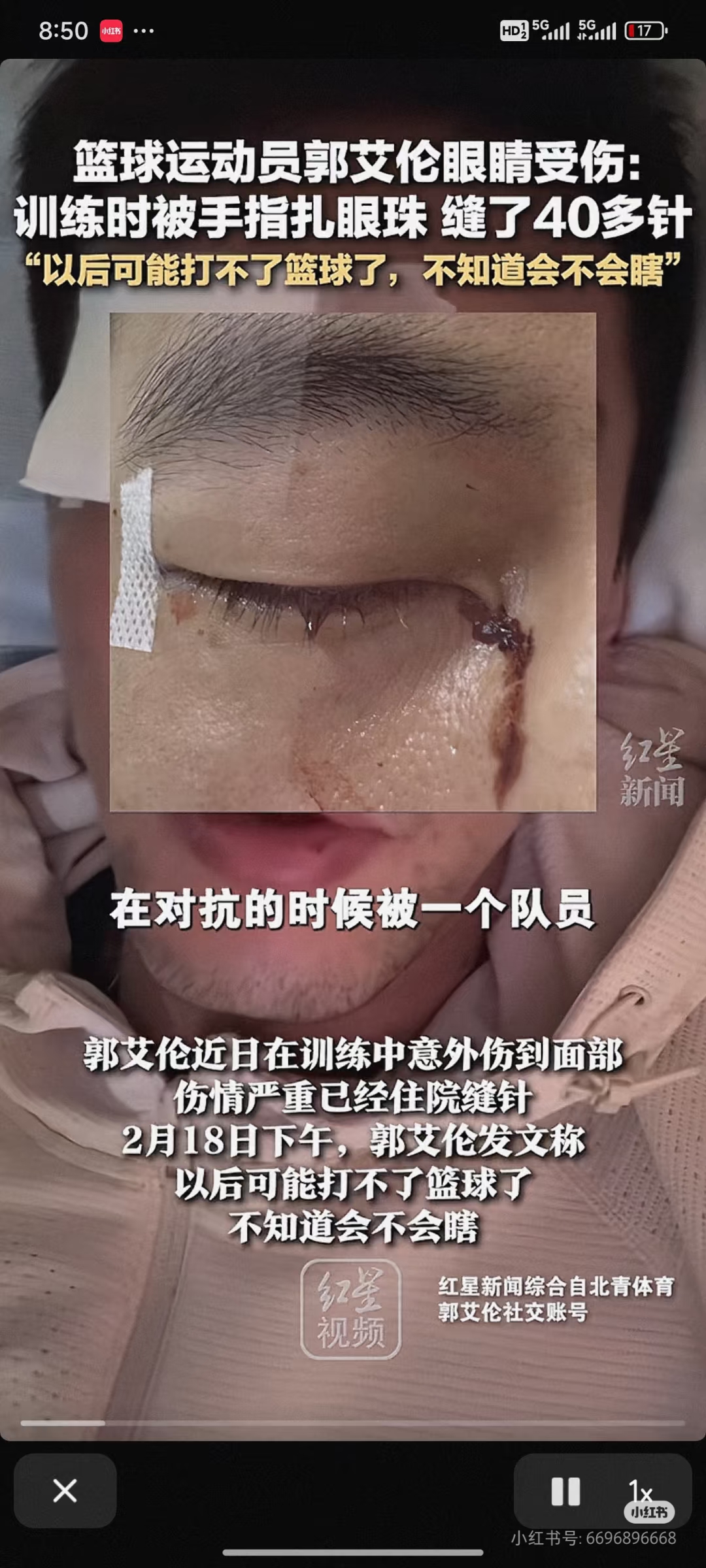 球星重伤需紧急动手术救治的简单介绍